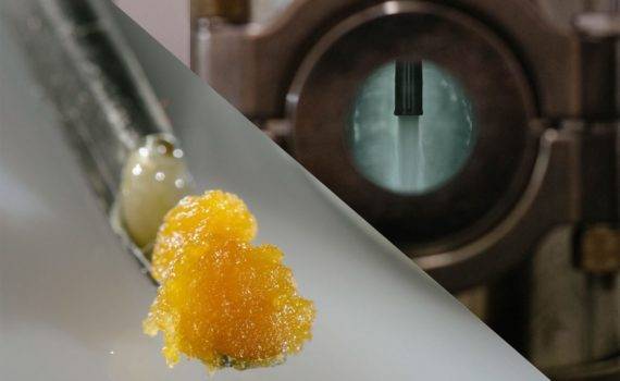 57 procent pacjentow z zapaleniem stawow 00