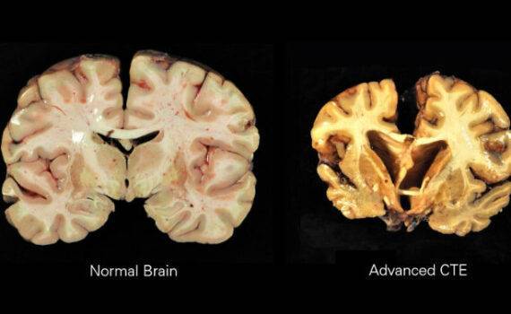 Kannabinoidy cialo 3
